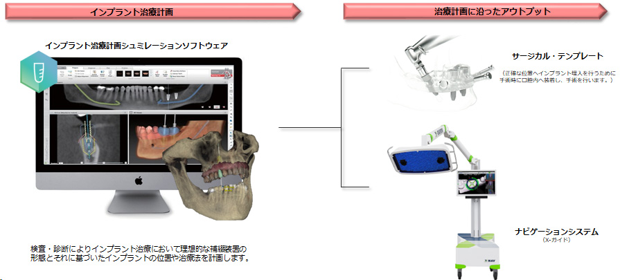 より安心なインプラント治療のために